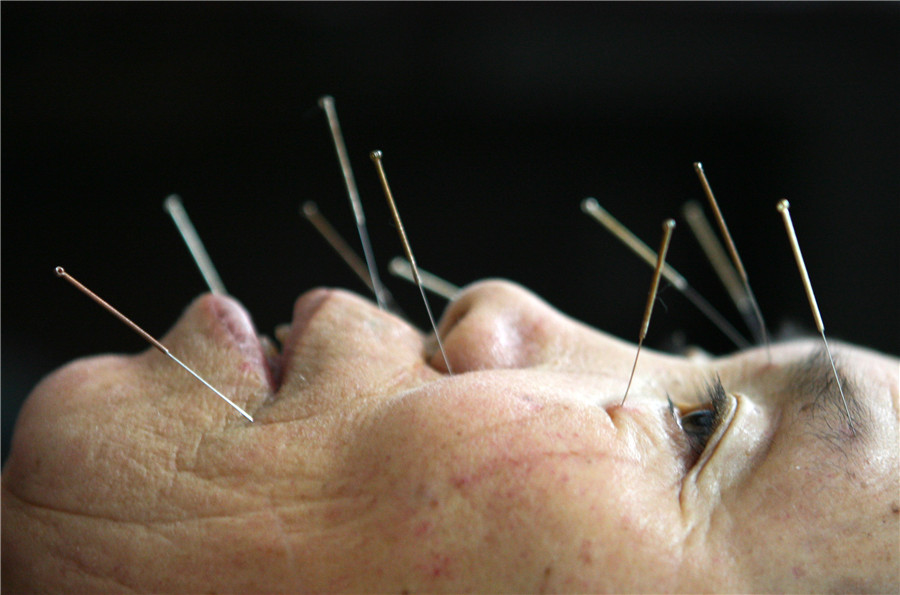 La Medicina Tradicional China se preserva y desarrolla